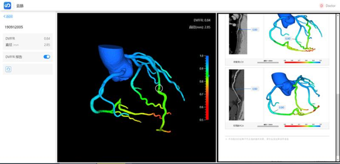 图为冠脉血流储备分数计算软件成像界面。（石景山区市场监管局供图）2
